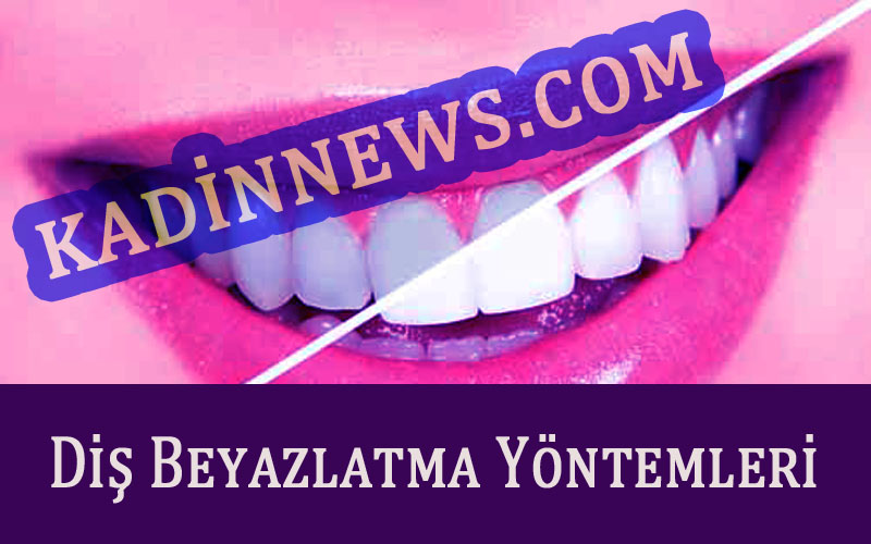 Diş Beyazlatma Yöntemleri - Kadinnews.Com